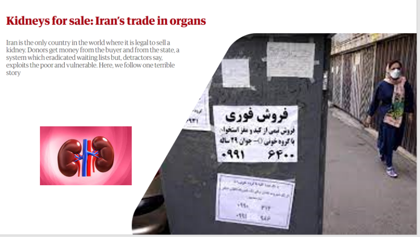 اليأس والواقع المرير: تجارة إيران المروعة في الأعضاء البشرية